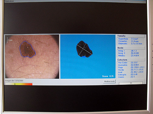 fotofinder